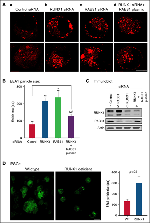 Effect on EE morphology on siRNA knockdown of RUNX1 or RAB31 in megakaryocytic HEL cells and in iMK differentiated from WT and RHD iPSCs. (A) Immunofluorescence studies on the effects of siRNA knockdown of RUNX1 and RAB31 in megakaryocytic HEL cells immobilized on coverslips and stained for EEA1 in: (a) control cells; (b) cells treated with RUNX1 siRNA, showing striking enlargement of EEA1 particles; (c) cells treated with RAB31 siRNA, showing similar alteration in EEs; and (d) RUNX1-depleted cells with RAB31 reconstitution showing partial reversal of EEA1 abnormality. In each column, 2 random examples of cells are shown. (B) Quantification of the size of EEA1 particles with RUNX1 or RAB31 depletion by siRNAs and with RAB31 reconstitution by RAB31 plasmid in RUNX1-depleted cells is shown. Presented as mean ± standard error of the mean of 3 independent experiments. (C) Immunoblotting showing RUNX1, RAB31, and actin (loading control) in control cells and with knockdown of RUNX1 or RAB31 and after RAB31 reconstitution in RUNX1-depleted cells. (D) Early endosomal defect in iMKs differentiated from iPSCs generated from a patient with RUNX1 mutation (RHD) compared with those from WT iPSCs. Scale bar = 10 µm. P values (*P < .001; **P < .0001) are for comparisons with control siRNA. NS, not significant.