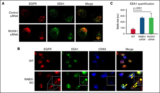 Effect of siRNA RUNX1 knockdown and CRISPR/Cas RAB31 knockout in megakaryocytic HEL cells on EGFR trafficking. (A) Effect of siRNA knockdown of RUNX1. Cells were exposed to EGF (0.25 μg/mL) for 8 minutes, immobilized on coverslips, and stained for EEA1 and EGFR. Compared with WT cells (upper panels), with RUNX1 knockdown (lower panels) there was marked enlargement of EEA1-positive vesicles (green) with colocalization of EGFR (red). (B) CRISPR/Cas9 RAB31 knockout (KO) cells were exposed to EGF for 8 minutes and immobilized on coverslips, and stained for EGFR (red), EEA1 (green), and CD63 (blue). Compared with WT cells (upper panels), with RAB31 KO (lower panels), there was enlargement of EEA1-positive vesicles with colocalization of EGFR, shown by yellow arrows and the insets. There was partial colocalization of EGFR with CD63. (C) Quantification of size of EEA1-positive particles in WT, RUNX1-depleted, and RAB31-depleted cells. Presented as mean ± standard error of the mean of 3 independent experiments. Scale bar = 10 µm.