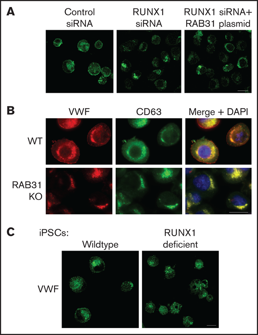 Effect on VWF trafficking in HEL cells of RUNX1 knockdown by siRNA and of RAB31 knockout by CRISPR/Cas targeting, and in iMKs differentiated from WT iPSCs and iPSCs generated from a subject with a RUNX1 mutation. (A) RUNX1-knockdown in HEL cells. PMA-treated HEL cells were nucleofected with control or RUNX1 siRNA and with RAB31 plasmid along with RUNX1 siRNA. They were stained for VWF (green). Cells with control siRNA showed VWF in the perinuclear regions and a band along the plasma membrane, which was lost on RUNX1 knockdown. RAB31 reconstitution did not restore the plasma membrane VWF. (B) RAB31-CRISPR/Cas knockout (KO) in HEL cells. Immunostaining for VWF (red), CD63 (green, late endosome/MVB), and their overlap (yellow). In WT cells. VWF is present in the perinuclear regions and at the plasma membrane as a rim of red dots, with an overlap between VWF and CD63 (yellow). In RAB31 KO cells, VWF was absent at the plasma membrane with an overlap of VWF and CD63-positive areas, suggesting retention of VWF in late endosomes/MVBs and defective VWF trafficking to plasma membrane. (C) iMKs differentiated from WT iPSCs and RHD-iPSCs with RUNX1 mutation were stained for VWF (green). The RHD-iMKs showed a loss of the plasma membrane VWF. Scale bar = 10 µm. DAPI, 4′,6-diamidino-2-phenylindole.