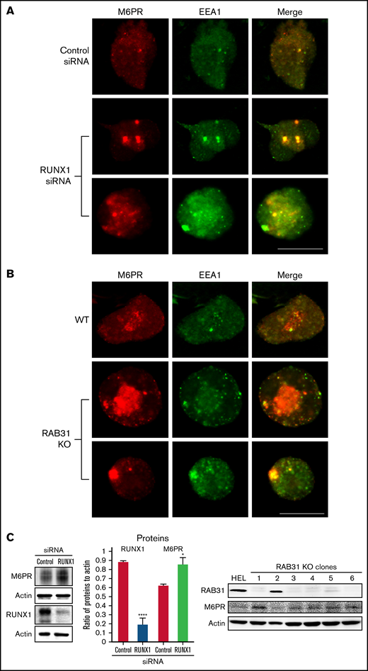 Effect on M6PR trafficking in HEL cells of RUNX1 siRNA knockdown and of RAB31-CRISPR/Cas9 knockout (KO). HEL cells were immobilized on cover slips and immunostained for M6PR (red) and EEA1 (green). Shown are images from confocal microscopy. (A) RUNX1 knockdown. (B) RAB31 KO. Under both conditions, in WT cells there is partial colocalization of M6PR with EEA1. With RUNX1 knockdown or RAB31 KO, there is colocalization of M6PR with enlarged EEA1 particles in the merged images. (C) Left panel: Immunoblotting on HEL lysates transfected with control or RUNX1 siRNA. Actin was used as loading control. Bars show densitometric analysis on immunoblot protein expression. Presented as mean ± standard error of the mean of 4 independent experiments. M6PR expression was increased in RUNX1 siRNA-depleted cells. Right panel: Immunoblotting shows M6PR expression in RAB31-KO (CRISPR/Cas) clones and actin as loading control. M6PR expression was increased in 5 of 6 clones with RAB31 KO. Scale bar = 10 µm. P values indicate comparisons vs control siRNA; *P < .001, ****P < .0001.