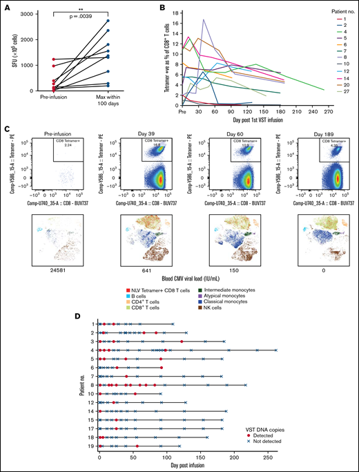 Virus-specific T-cell responses and cell persistence in post-infusion samples. (A) ELISpot assay showing preinfusion and maximum CMV-induced IFN-γ production within 100 days after infusion. Statistical significance was evaluated with a 2-tailed Wilcoxon matched-pairs signed-rank test. (B) Tetramer responses for 12 patients with >1% expression, showing elevation and persistence over time. (C) Tetramer responses for patient 8 shown in composite at 4 time points. For each time point, biaxial flow plots, tSNE of major cell populations, and blood viral load (below each tSNE plot) are shown. (D) Microchimerism assessed by ddPCR in 15 patients. Informative insertion-deletion polymorphisms (indels) that distinguished the third-party VST donor from the transplant donor and recipient were identified. Adoptively transferred VST product was detected in the peripheral blood of all patients up to day 120 after infusion, all quantified below 3 copies per 100 ng of DNA. Day 0 results were from samples taken 2 hours after VST administration. Patient 6 withdrew from the study and had no further time points after day 92. tSNE, t-distributed stochastic neighbor embedding.