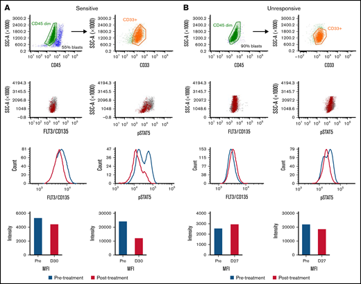 FLT3 and pSTAT5 expression in response to gilteritinib treatment. Using spectral flow, a sensitive (A) and an unresponsive (B) primary sample were first gated for myeloblasts using AML surface markers (CD45 dim and CD33+) and then FLT3/CD135 and pSTAT5 expression. Pre-treatment samples are indicated in blue, and post-treatment samples are indicated with red. MFI, mean fluorescent intensity.