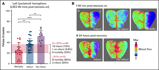 Cortical perfusion measurements are predictive of stroke outcomes in the iCAT model. C57BL/6 mice were subjected to the iCAT stroke model (60 minutes’ ischemia), with LCSI assessed at 90 minutes’ poststroke onset (stenosis on). Mice were then recovered and assessed for stroke outcomes, including mortality and presence of infarction at 24 hours. (A) Quantification of cerebral perfusion at 90 minutes, grouped according to 24-hour stroke outcome (mortality, infarct/no infarct), with data depicted as the mean ± standard deviation, with statistical significance analyzed by using an ordinary one-way analysis of variance with Šidák’s multiple comparisons test, where **P < .01, ****P < .0001. (B) LSCI examples show flux readouts of cortical cerebral perfusion in the ipsilateral (left; L) and contralateral (right; R) hemisphere at 90 minutes (i) and 24 hours (ii) after stroke onset, with a representative image taken from 1 of all 3 stroke outcome categories assessed (ie, mortality, no infarct, and infarct). Experiments were conducted at ambient temperature <21°C (Site 1).