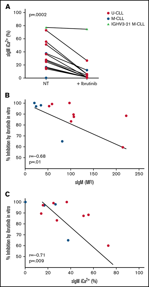 SIgM levels/signaling capacity inversely correlate with signaling inhibition by ibrutinib in vitro. CLL cells taken before ibrutinib therapy start were treated with 10 µM of ibrutinib in vitro (n = 13). Red symbols represent U-CLL; blue symbols represent M-CLL; the green triangle represents a IGHV3-21 M-CLL case. (A) SIgM-mediated iCa2+ mobilization was measured by flow cytometry. Non treated cells (NT) were incubated with DMSO as a control. (B-C) Correlation between percent signaling inhibition by ibrutinib in vitro and sIgM MFI (B) or sIgM signaling capacity (iCa2+ mobilization) (C) measured prior to ibrutinib treatment. Case 495 (IGHV3-21 M-CLL) was excluded from the graphs for better visualization of the correlation. Analysis and Spearman correlation were performed on all 13 cases.