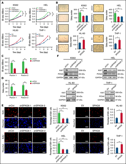 SPAG6 promoted proliferation and G1 to S phase transition in leukemic cells. (A-B,E). K562 and HEL cells were transduced with lentiviral particles expressing different shRNA clones directed against SPAG6 (shSPAG6-1 and shSPAG6-2). The cell lines HL-60 and THP-1 were transduced with lentiviral particles expressing SPAG6 or EV. The cell proliferative capacities were detected by CCK-8, colony formation, and EdU assays in K562, HEL, HL-60, and THP-1 cells with treatment as indicated. (C-D) Proliferation and colony formation of CD34+ cells from a patient with favorable risk (Patient 1) and a patient with poor risk (Patient 2) when SPAG6 was knocked down. (F) Western blot detection for expression levels of Ki67 and PCNA. (G) AML cell migration was determined by Transwell assay. (H) Flow cytometry analysis showing cell cycle distribution in K562, HEL, THP-1, and HL-60 cells with treatment as indicated. (I) Western blot analysis showing the expression levels of cyclin D1, cyclin E1, CDK2, and CDK4 in AML cells with treatment as indicated. Scale bar, 50 μm. *P < .05; **P < .01. PCNA, proliferating cell nuclear antigen.