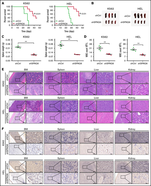 Knockdown of SPAG6 inhibits the growth and dissemination of AML in vivo. (A) Kaplan-Meier curves showed the survival rate of mice injected with K562-shSPAG6 cells and HEL-shSPAG6 cells (n = 8 mice per group). (B-C) Representative examples of size and weight of spleens derived from leukemic mice with treatment as indicated. (D) White blood cell count in all the study groups. (E-F) Representative hematoxylin and eosin and immunohistochemical staining images of CD45 in BM, spleen, liver, and kidney, treated as indicated. Scale bar, 50 μm. **P < .01.