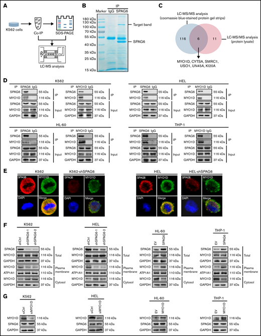 SPAG6 interacts with MYO1D and promotes the translocation of MYO1D to the plasma membrane. (A) A schematic representation of mass spectrometry detection. (B) Immunoprecipitation (IP) assay was carried out using SPAG6 antibody or IgG (negative control antibody). Samples were electrophoresed and Coomassie Brilliant Blue stained. Arrows indicate SPAG6 and the target bands. (C) Venn diagram of the protein strip and the protein lysate detected by LC-MS/MS analysis. (D) Interaction between SPAG6 and MYO1D was demonstrated via Co-IP in K562, HEL, HL-60, and THP-1 cells. (E) Representative images showing immunofluorescence staining of SPAG6 (red), MYO1D (green), and DAPI (blue) in K562 and HEL cells with treatment as indicated. Scale bar, 25 μm. (F) Western blot verified the different distribution of MYO1D in leukemia cells. (G) Western blot demonstrated SPAG6 expression with knockdown or overexpression of MYO1D in 4 AML cells. Co-IP, co-immunoprecipitation.