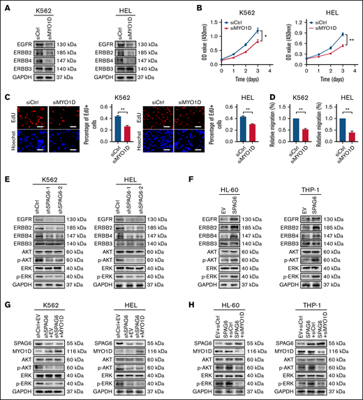 SPAG6 activates the PI3K/AKT and ERK signaling pathways in a MYO1D-dependent manner. (A) Western blot showing EGFR, ERBB2, ERBB3, and ERBB4 expression in K562 and HEL cells with MYO1D knockdown. (B-C) The proliferative capacities of K562 and HEL cells with MYO1D knockdown were detected by CCK-8 and EdU assays. (D) Migration of K562 and HEL cells when MYO1D was knocked down. (E-F) Western blot showing the concentrations of EGFR, ERBB2, ERBB3, ERBB4, AKT, p-AKT, ERK, and p-ERK in 4 AML cells treated as indicated. (G-H) Western blot showing the concentrations of AKT, p-AKT, ERK, and p-ERK in K562, HEL, HL-60, and THP-1 cells with treatment as indicated. *P < .05; **P < .01.