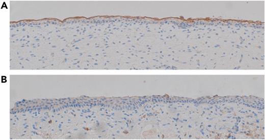 Epidermal TF expression. Immunohistochemical staining for TF in (A) a periumbilical skin sample of a fetus at gestational week 15 and (B) the foreskin of a 4-year-old boy. Pictures were taken at original 20× magnification.