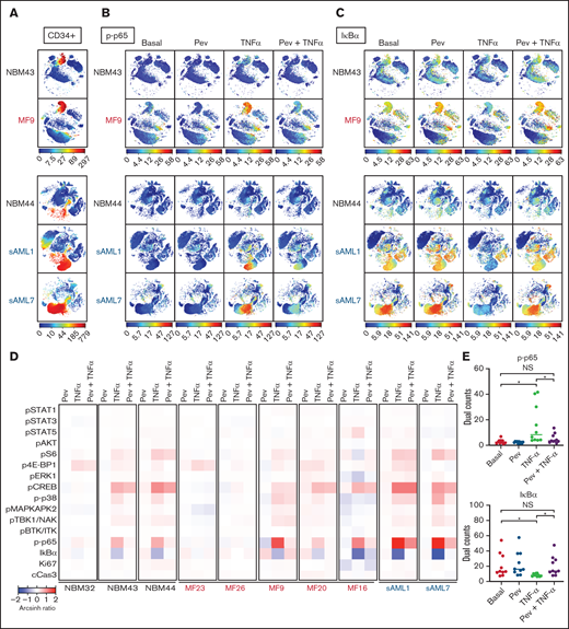 Mass cytometry reveals blunting of TNFα responses by pevonedistat in MF and sAML. (A-C) viSNE plots of healthy, normal BM donors (NBM 43, 44) and MF and sAML patient samples after signaling mass cytometry. (A) CD34+ HSPC population identified through extracellular surface staining with anti-CD34 antibody. Intracellular staining of phospho-p65/RELA (S529) (B) and IκBα (C) in patient samples treated with 1 µM pevonedistat for 1 hour, 20 ng/mL TNFα for 15 minutes, or in combination. (D) Heatmaps of signaling markers from CD34+ cells from 3 normal BM donors, 5 primary MF patients, and 2 sAML patients analyzed by mass cytometry. Cells from patient samples were treated with 1 µM pevonedistat for 1 hour, 20 ng/mL TNFα for 15 minutes, or in combination. Signals from each patient sample per treatment condition were normalized to its basal signal. (E) Dual counts of intracellular phospho-p65/RELA and IκBα from CD34+ cells from the 10 patient samples in panel D. *P < .05 by Mann-Whitney U test. NS, not significant.