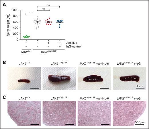 Spleen analysis of untreated and treated JAK2+/V617F mice. (A) Comparison of splenic weight measurement of untreated healthy JAK2+/+ mice (n = 13), untreated JAK2+/V617F mice (n = 14), and anti–IL-6– (n = 9) and IgG-treated JAK2+/V617F mice (n = 10), respectively. Data are shown as mean ± standard error of the mean. JAK2+/+ vs JAK2+/V617F data are our laboratory’s internal control and are also partly reported in a manuscript by Müller et al.24 (B) Representative images of the isolated spleens of untreated healthy JAK2+/+, untreated JAK2+/V617F, and anti–IL-6 Ab– and IgG-treated JAK2+/V617F mice are shown (scale bar, 1 cm). (C) Representative images of histopathologic spleen sections are shown (scale bar, 500 μm). Isolated spleens of untreated JAK2+/+ and JAK2+/V617F mice as well as anti–IL-6– and IgG-treated JAK2+/V617F mice were stained with hematoxylin and eosin. DM6000 B Microscope (Leica Microsystems, Wetzlar, Germany) and LAS (version 3.8) software (Leica Microsystems) were used for micrographs at room temperature. ****P < .0001 by nonparametric, 2-tailed Mann-Whitney test.