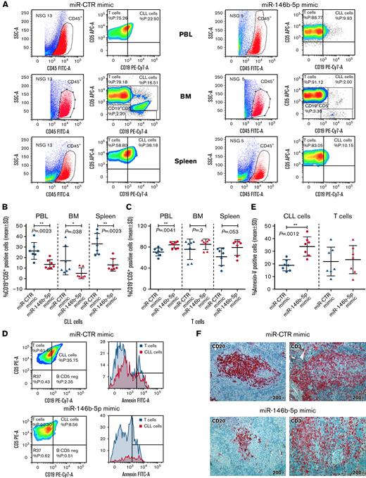 Effects of in vivo treatment with miRNA mimics on CLL cells engrafted in NSG mice. Mice were injected with 50 × 106 CLL cells prestimulated with autologous activated T cells. After 4 to 6 weeks, blood samples were evaluated for the presence of circulating leukemic cells by flow cytometry, and after CLL cell engraftment was achieved, the mice were treated with 3 doses of miR-146b-5p or miR CTR mimic. Mice were sacrificed after 3 days from the last inoculum, and cell suspensions from the spleen, bone marrow (BM), and peripheral blood (PBL) were analyzed by flow cytometry for the percentage of CD19+CD5+ CLL cells or CD19−CD5+ T cells over the total of human CD45+ cells. (A) Flow cytometry analysis of 2 representative mice injected with CLL GE1-PM129 and treated with miR CTR mimic (NSG 13) or miR-146b-5p (NSG 5). (B) Summary of the flow cytometry analyses of 14 mice injected with CLL cells from 2 different cases (GE1-PM129 and GE1-RO148) and treated as in (A). Percentages of CD19+CD5+ CLL cells or (C) CD19−CD5+ T cells are shown. (D) Apoptotic neoplastic cells and T cells in the spleen from a miR-146b-5p (NSG 16) and a miR CTR (NSG 13) mimic-treated mouse. Apoptotic cells were detected by flow cytometry as annexin-V–positive cells by gating CD45+CD19+CD5+ CLL cells (solid red histogram profiles) or CD45+CD19−CD5+ T cells (solid blue histogram profiles). (E) Summary of the flow cytometry tests carried out in 14 mice treated as in (D). Percentages of apoptotic CLL and T cells are expressed as mean ± SD. (F) High-power magnification (200×) images of longitudinal sections of paraffin-embedded mouse spleen stained with αCD20-Ab or αCD3-Ab showing the infiltrating foci present in mice treated with miR CTR (NSG 13) or miR-146b-5p mimics (NSG 16).