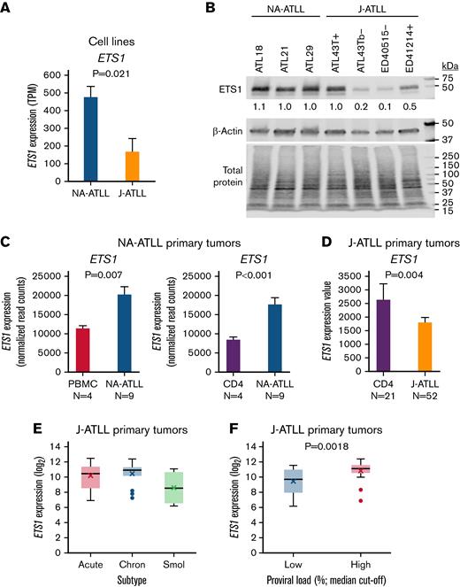ETS1 expression is upregulated in NA-ATLL cell line and primary tumor cells. (A) RNA-seq ETS1 expression in NA-ATLL (n = 4) compared with J-ATLL (n = 4) cell lines. Mean ± standard error (SE); 2-sided t test; TPM, transcripts per million. (B) Western blot validation of ETS1 expression across ATLL cell lines. ETS1 relative abundance is normalized to total protein. (C) ETS1 expression is elevated in NA-ATLL primary tumor cells compared with PBMCs and CD4 T cells derived from healthy donors. RNA-seq; mean normalized read counts ± SE; FDR-corrected P value. (D) ETS1 expression in J-ATLL primary tumor cells compared with healthy donor CD4 cells. FDR-corrected P value. (E) ETS1 expression across ATLL subtypes (P = .113). Chron, Chronic; Smol, Smoldering. (F) ETS1 expression stratified by low and high proviral load (median cutoff: proviral load 78.4%, P = .0018).