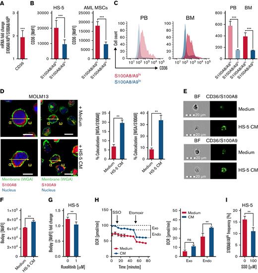 S100A8/A9hiAML cells display enhanced fatty acid metabolism. (A) Gene expression of the fatty acid translocase CD36 was determined in FACS-sorted S100A8/A9hi and S100A8/A9lo OCI-AML (n = 3) and MOLM-13 (n = 3) cells cultured for 48 hours in the presence of HS-5 CM by qPCR and is shown as the fold change (S100A8/A9lo cells were set as 1). (B) Surface levels of CD36 were determined by flow cytometry on S100A8/A9hi and S100A8/A9lo cells among the AML cell lines cultured for 48 hours in the presence of CM from either HS-5 cells (left; OCI-AML, n = 4; MOLM-13, n = 4) or AML-MSCs isolated from 6 patients (right; OCI-AML, n = 12; MOLM-13, n = 12, patient ID 11-16; supplemental Table 1). (C) Surface levels of CD36 were analyzed by flow cytometry in matched-pair (n = 10; patient ID 1-10; supplemental Table 1) PB- and BM-derived S100A8/A9hi and S100A8/A9lo AML blasts, as representatively shown in histograms (left) and summarized in a bar graph (right). (D) Localization of S100A8 and S100A9 was visualized by fluorescence microscopy (left, scale bars = 20 μm). MOLM-13 cells (n = 5) were cultured in the absence (top) or presence (bottom) of HS-5 CM and stained for the cell membrane (WGA, green), S100A8 (left, red) or S100A9 (right, red), and the nucleus (blue, DAPI). Co-localization of S100A8/S100A9 and WGA were calculated with ZEN software (bar graphs; Zeiss). (E) A proximity ligation was performed with a Duolink Flow kit (Sigma-Aldrich) with antibodies against S100A8, S100A9, and CD36. The representative images show the bright-field (left, BF) and the fluorescence signal (right) in MOLM-13 cells. Bars represent 20 μm for 20× magnification. (F) Long-chain fatty acid uptake by AML cell lines (OCI-AML, n = 5; MOLM-13, n = 5) cultured for 48 hours in absence or presence of HS-5 CM was measured by flow cytometry using the fluorescent probe Bodipy FLC16 based on the median fluorescence intensity (MdFI). (G) Long-chain fatty acid uptake was analyzed in AML cell lines cultured for 48 hours in the absence or presence of HS-5 CM, with or without ruxolitinib (OCI-AML, n = 2; MOLM-13, n = 3). (H) Oxygen consumption rate (OCR; as a surrogate for oxidative phosphorylation) was determined for MOLM-13 cells (n = 3) cultured for 48 hours in the absence (absence) or presence of HS-5 CM (CM) at baseline and after consecutive injection of SSO and etomoxir, which enabled calculation of the dependence on exogenous (exo) and endogenous (endo) fatty acids for fueling mitochondrial respiration. (I) S100A8/A9hi frequency was analyzed in AML cell lines (OCI-AML, n = 5; MOLM-13, n = 4) cultured for 48 hours in the presence of HS-5 CM, with or without the CD36 inhibitor SSO. Data are expressed as the standard error of the mean. ∗P < .05; ∗∗P < .01; ∗∗∗P < .001; ns, not significant. DAPI, 4′,6-diamidino-2-phenylindole; FACS, fluorescence-activated cell sorting; qPCR, quantitative real-time polymerase chain reaction.