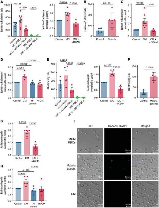 Adhesion molecule activation observed in malaria-altered uRBCs. (A) Laminin-α5 adherence was assessed by passing RBCs incubated in culture medium (control) and P. falciparum in vitro cultures (MC) over laminin-α5–coated Ibidi μ-slides. Lu/BCAM-mediated adhesion was tested by Lu/BCAM blocking antibody (MC+Lu/BCAM). Mean ± standard error of the mean (SEM); n = 4-7 (left). Cells were stained with the DNA dye Hoechst to distinguish iRBCs from uRBCs. Laminin-α5 adhesion frequency of MC-derived uRBCs was normalized to control RBCs (right). (B) RBCs from age-matched controls (n = 5) and patients with malaria (n = 6) were stained with Hoechst for iRBC detection and tested for laminin-α5 adherence. Mean ± standard deviation (SD); Mann-Whitney test. (C) RBCs exposed to malaria-conditioned medium (CM) overnight were assessed for Lu/BCAM-mediated laminin-α5 adherence. Mean ± SEM; n = 4-7. (D) RBCs incubated with heat-treated (1 hour, 56°C) (HI CM) were passed over laminin-α5 coated μ-slides, to determine the heat stability of the laminin adhesion–inducing factor in CM. Mean ± SEM, n = 4. (E) Quantification of HA interaction was performed by passing RBCs derived from control and MC conditions on HA-coated μ-slides. CD44-mediated interaction was assessed by CD44 blocking antibody. The frequency of HA interaction of uRBCs was normalized to control RBCs. iRBCs were stained with Hoechst. Mean ± SEM, n = 3-4. (F) Frequency of HA interaction of uRBCs in patients with malaria was compared with those from age-matched controls. Samples were stained with Hoechst for iRBC-uRBC distinction. Mean ± SD; n = 4; Mann-Whitney test. (G) CD44 mediated HA interaction of CM-exposed RBCs was assessed by passing CM RBCs and CD44-blocked CM RBCs over HA-coated μ-slides. HA-rolling of treated cells were normalized to control RBCs. Mean ± SEM; n = 4-7. (H) Heat instability of the factor that mediates HA interaction was tested under flow conditions with RBCs incubated with HI CM. Mean ± SEM, n = 5. (I) Microscopy images of laminin-α5 adherent control RBCs (i), malaria culture RBCs (ii), and CM-exposed RBCs (iii). Hoechst staining (blue) indicates iRBCs. Images were taken under a ×40 oil-immersion objective. Bars represent 20 μm. Wilcoxon matched-pairs signed-rank test, unless stated otherwise. The error bar denotes SEM or SD.