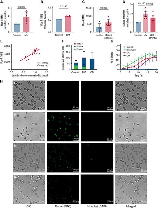 Laminin-α5–adherent uRBCs are characterized by elevated intracellular Ca2+levels. (A) Intracellular Ca2+ levels of malaria culture–derived uRBCs (MC) normalized to control RBCs (control). Mean ± standard error of the mean (SEM); n = 6. (B) Intracellular Ca2+ levels of RBCs incubated in malaria conditioned medium (CM) normalized to control RBCs (control). Mean ± SEM; n = 7. (C) Intracellular Ca2+ levels of uRBCs derived from patients with malaria and age-matched control. Mean ± standard deviation (SD); n = 5-6; Mann-Whitney test. (D) Normalized laminin-α5 adherence of RBCs exposed to CM, with or without BAPTA treatment. Mean ± SEM, n = 4. (E) Mean fluorescence intensities (MFI) of Fluo-4 from malaria culture uRBCs (y-axis) were plotted against laminin-α5 adherence normalized to that of control RBCs (x-axis; n = 18). (F) Fluo-4–stained RBCs from control-, MC-, and CM-incubated RBCs were passed over laminin-α5–coated Ibidi μ-slides at a flow rate of 0.2 dyn/cm. Laminin-α5–bound RBCs were quantified and analyzed for Fluo-4 positivity by Arivis Vision 4D image analysis software. iRBCs were assessed by Hoechst staining. Mean ± SEM, n = 3-6. (G) uRBC ghosts were identified as spherical translucent Hoechst-negative cells and quantified over the course of 20 hours. Mean ± SEM; n = 4. (H) Ca2+ permeability of control RBCs (i), ionomycin-treated RBCs (ii), malaria cultured RBCs (iii), and RBCs incubated in malaria CM (iv) after 8 hours of experimental measurement. RBCs were stained for intracellular Ca2+ by Fluo-4 (green) and Hoechst (blue) for iRBC detection. (I) Representative microscopy images of RBCs incubated with iRBCs on laminin-α5–coated microscopic chambers at 0 hours of laminin-α5 incubation. Monocytes (arrows) were added after a 24-hour laminin-α5 incubation to carboxyfluorescein diacetate succinimidyl ester–stained RBCs (green), hemolyzed uRBCs (∗) and Hoechst-stained iRBCs (blue). (J) Phagocytosis of hemolyzed uRBCs (∗) by unstained monocytes (arrow) when co-incubated with iRBCs on laminin-α5–coated microscopic chambers. Red outlines show uRBC uptake by monocytes. Images in panels H, I, and J were obtained under a ×40 oil-immersion objective. Bars represent 20 μm. Wilcoxon matched-pairs signed-rank test, unless stated otherwise. Error bars denote SEM or SD.