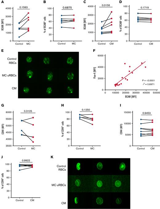 Lu/BCAM clusters are present on malaria altered uRBCs. (A) Surface expression of Lu/BCAM on control RBCs (control) and malaria culture–derived uRBCs (MC). Data represent the mean fluorescence intensities (MFI) of control RBCs and MC uRBCs. n = 6. (B) Percentage of Lu/BCAM+ RBCs in control RBCs and MC-derived uRBCs. n = 6. (C) Surface expression of Lu/BCAM on control RBCs and RBCs exposed to CM. The data represent the MFI values of control RBCs and CM RBCs. n = 7. (D) Percentage of Lu/BCAM+ RBCs in control RBCs and CM-exposed RBCs. n = 6. (E) Imagestream analysis was performed to visualize surface expression of Lu/BCAM (green) on control RBCs, uRBCs derived from malaria culture (MC uRBCs), and RBCs exposed to CM (magnification ×60). (F) MFIs of Fluo-4–stained uRBCs from MC (y-axis) were plotted against the surface expression of Lu/BCAM (x-axis). n = 16. (G) Surface expression of CD44 on control RBCs (control) and MC-derived uRBCs. Data represent the MFIs of control RBCs and MC uRBCs. n = 5. (H) Percentage of CD44+ RBCs in control RBCs and MC-derived uRBCs. n = 5. (I) Surface expression of CD44 on control RBCs and CM RBCs. Data represent the MFIs of control RBCs and CM RBCs. n = 8. (J) Percentage of CD44+ RBCs in control RBCs and CM-exposed RBCs. n = 8. (K) Representative images of CD44 (green) stained control RBCs, uRBCs from malaria culture (MC uRBCs) and RBCs exposed to malaria CM visualized by imaging flow cytometry (magnification ×60). Wilcoxon matched-pairs signed-rank test.