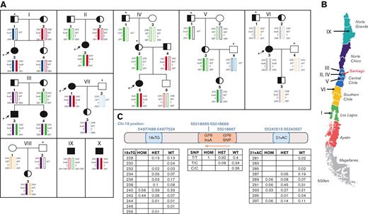 The genetic etiology of the founder GP6 mutation found in Chilean patients. (A) Pedigrees showing a pattern of inheritance and different haplotypes surrounding the GP6InsA mutation site in identified Chilean families. (i-viii), Pedigrees including 6 probands (marked by a P and an arrow) and 2 heterozygous cases, wherein which the DNA of family members was also available for sequencing. For relatives who were not sequenced, we inferred the most likely haplotype based on sequencing results from samples provided; these individuals are marked with an asterisk (∗) and their inferred haplotype, assuming a normal pattern of inheritance and no recombination events, is in italics. (ix-x), Haplotypes of 2 individuals with homozygous mutation in which no DNA of family members was available. Color coding has been used to show inheritance patterns of alleles (block color alleles carry the GP6InsA haplotype). Squares indicate males, and circles indicate females. Blank shapes indicate GP6WT/WT status, half-filled shapes indicate GP6WT/InsA status and filled shapes indicate GP6InsA/InsA status. (B) Map of Chile indicating geographical sites of origin where patients have been diagnosed (arrowed). Santiago, Chile’s capital city, is indicated in red. Map adapted from www.touropia.com with permission. (C) The position of the microsatellite markers (18xTG and 21xAC), the GP6 exon 6 mutation (clinVar ID number 1072837), and the GP6 common SNP rs1654416 on chromosome 19 are shown. Tables show the relative frequencies of fragment size for each microsatellite marker and SNP status, in the 3 genetic groups investigated. The orange arrow shows the direction of GP6 transcription. HOM = GP6InsA/InsA, HET = GP6WT/InsA, WT = GP6WT/WT. n = 9 for GP6InsA/InsA, 50 for GP6WT/InsA and 36 for GP6WT/WT.