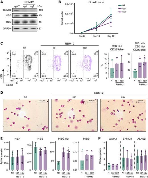 RBM12 depletion in primary human CD34+HSPCs does not impair erythroid maturation. CRISPR/Cas9 depletion of RBM12 in human CD34+ HSPCs via 2 independent sgRNAs (n = 3 biological replicates). (B, C, E, and F) Plotted are means ± standard deviation. (A) Western blot analysis with indicated antibodies at day 15 of differentiation. (B) Growth curve displaying total cell number from day 8 to 12 of differentiation. (C) Left: Representative contour plots of CD71 vs CD235ab at day 15 of differentiation. Right: Quantification of CD71loCD235ab+ and CD71loCD235ab+/HbF+ cells. ∗P < .05 by Student’s t test. (D) Representative May-Grünwald Giemsa images of HSPCs at day 15 of differentiation. (E) qRT-PCR analysis of globin genes at day 12 of differentiation. Results are normalized to HPRT1. ∗P < .05 by Student’s t test. (F) qRT-PCR analysis of differentiation markers GATA1, BAND3, and ALAS2 at day 12 of differentiation. Results are normalized to HPRT1.