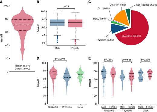 Age and etiological distributions of acquired PRCA in the Ptosh cohort. A total of 1055 patients with PRCA were identified in Ptosh. (A) A violin plot showing the age distribution of the patients. A total of 76% of them were >60 years old. (B) Distributions of the age of the patients with PRCA were depicted by sex, and we did not find a significant difference in age distributions (P = .3). (C) The pie chart shows an etiological distribution of PRCA in the present study. Among the 1055 patients with acquired PRCA, 69.0% had idiopathic PRCA. Other underlying causes included thymoma (9.4%), LGLL (2.5%), CLL (0.6%), and others (14.3%). (D) Age distributions in the 3 major subtypes of acquired PRCA were depicted in a violin plot, and a statistical difference was recognized between idiopathic and thymoma-associated PRCA, with median ages of 75 (range, 20-99) years old and 67 (range, 33-90) years old, respectively (P = .0006). A bimodal age distribution was observed in those with LGLL-associated PRCA. (E) The age distributions were not different between genders in respective subtypes of PRCA. The bimodal distribution in those with LGLL-associated PRCA was preserved in each gender group.