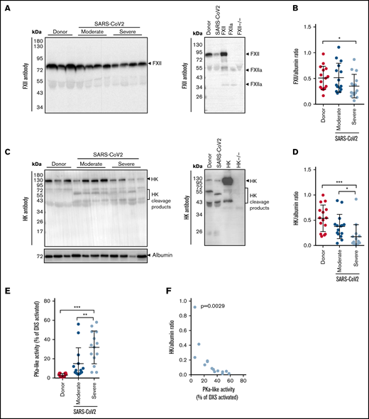 Activation of the contact-phase system in plasma of patients critically ill with COVID-19. (A,C) Western blot analysis (left) of FXII (A) and HK (C) in plasma from patients with moderate or severe COVID-19 (SARS-CoV-2) and donors (healthy subjects). Four of 15 patients with moderate or severe COVID-19 and 3 of 15 donors are represented. Albumin was used as the loading control. The specificity of the antibodies used is shown (right). (B,D) Densitometric analysis of panels A and C, respectively. COVID-19 moderate/severe, n = 15; donor n = 15. (E) PKa-like activity in plasma of patients with moderate (n = 14) or severe (n = 14) COVID-19 and donors (n = 15). (F) Correlation between the levels of intact HK and PKa-like activity in plasma of patients with severe COVID-19 (n = 14). Correlation was performed according to Spearman’s rank correlation coefficient. *P < .05; **P < .01; ***P < .001.