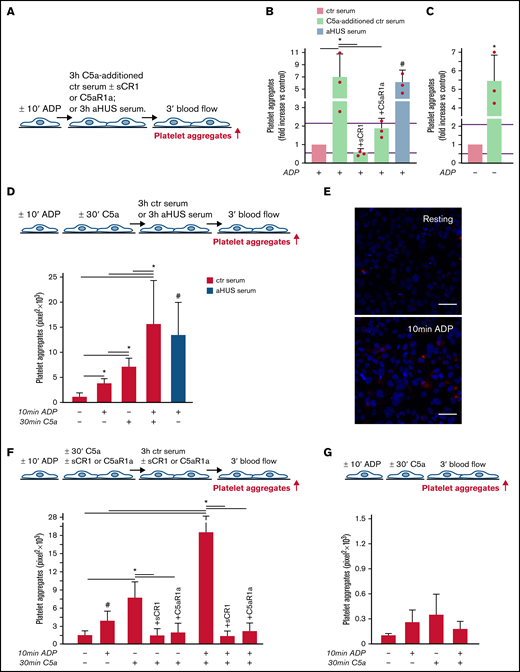 C5a and normal human serum (ctr) induces platelet adhesion and aggregation on HMEC-1. (A) Experimental design. HMEC-1, ADP-activated or resting, were exposed for 3 hours to ctr serum with or without the addition of C5a (200 ng/mL) or to aHUS serum, and then perfused for 3 minutes with heparinized whole blood, added with mepacrine, from healthy subjects. C5a-additioned serum was tested in the presence or absence of sCR1 (150 μg/mL) or the C5aR1 antagonist CCX168 (200 ng/mL). Formation of platelet aggregates was evaluated at the end of the blood perfusion. (B-C) Effect of C5a-additioned ctr serum on formation of platelet aggregates on HMEC-1 (B, ADP-activated; C, resting). Results are shown as fold increase of stained surface area after incubation with ctr serum alone run in parallel. Data are mean ± SD; n = 3 independent experiments. Red points represent fold increase values of single experiments. Purple lines are the upper and lower limits of normal range. *P < .05 vs the groups indicated by horizontal bar. #P < .05 vs ctr serum. (D, upper panel) Experimental design. HMEC-1 were activated or not with ADP for 10 minutes and then stimulated or not with C5a for 30 minutes, exposed for 3 hours to ctr serum, and perfused for 3 minutes with heparinized whole blood, added with mepacrine, from healthy subjects. On selected slides, ADP-activated cells were exposed to aHUS serum, taken as the positive control. Formation of platelet aggregates was evaluated at the end of the blood perfusion. (D, lower panel) Endothelial surface area covered by platelet aggregates after incubation with ctr serum of resting (no ADP, no C5a), ADP-activated, C5a-stimulated or ADP-activated/C5a-stimulated HMEC-1; or after incubation with aHUS serum. Data are mean ± SD; n = 4 independent experiments. *P < .05 vs the groups indicated by horizontal bar. #P < .05 vs resting and ADP-activated HMEC-1 + ctr serum. (E) Representative images of immunostaining for C5aR1 (red staining) on resting or ADP-activated HMEC-1. Blue: DAPI staining. Original magnification: ×400. Scale bar represents 50 μm. (F, upper panel) Experimental design. HMEC-1 were activated or not with ADP for 10 minutes and then stimulated or not with C5a for 30 minutes, exposed for 3 hours to ctr serum, and perfused for 3 minutes with heparinized whole blood, added with mepacrine, from healthy subjects. In 3 of 4 experiments, additional samples were run in which either sCR1 (150 μg/mL) or the C5aR1 antagonist CCX168 (200 ng/mL) were added during the C5a stimulation and the exposure to serum. Formation of platelet aggregates was evaluated at the end of blood perfusion. (F, lower panel) Endothelial surface area covered by platelet aggregates after incubation with ctr serum of resting, ADP-activated, C5a-stimulated or ADP-activated/C5a-stimulated HMEC-1. Data are mean ± SD; n = 3 to 4 independent experiments. *P < .05 vs the groups indicated by horizontal bar. #P < .05 vs resting. (G, upper panel) Experimental design. HMEC-1 were activated or not with ADP for 10 minutes and then stimulated or not with C5a for 30 minutes and perfused for 3 minutes with heparinized whole blood, added with mepacrine, from healthy subjects. Formation of platelet aggregates was evaluated at the end of blood perfusion. (G, lower panel) Endothelial surface area covered by platelet aggregates on resting, ADP-activated, C5a-stimulated or ADP-activated/C5a-stimulated HMEC-1. Data are mean ± SD; n = 3 independent experiments.