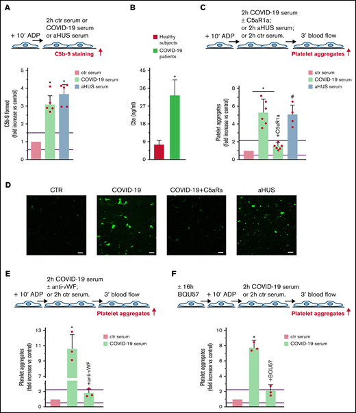 Terminal complement activation, and role of C5a/C5aR1 signaling in COVID-19 serum-induced platelet adhesion and aggregation on HMEC-1. (A) Endothelial surface area covered by staining for C5b-9 after incubation of ADP-activated HMEC-1 for 2 hours with ctr serum, or serum from patients with COVID-19 or aHUS, taken as positive controls. Results are shown as fold increase of stained surface area after incubation with ctr serum run in parallel. Data are mean ± SD n = 5 independent experiments. Red points represent fold increase values of single experiments. Purple lines are the upper and lower limits of normal range (calculated as shown in supplemental Figure 2). *P < .05 vs control. (B) C5a levels in plasma from healthy subjects (n = 10) or patients with COVID-19 (n = 4). Data are mean ± SD. *P < .05 vs healthy subjects. (C, upper panel) Experimental design. ADP-activated HMEC-1 were exposed for 2 hours to ctr serum or serum from patients with COVID-19 or aHUS taken as positive control, and then perfused for 3 minutes with heparinized whole blood, added with mepacrine, from healthy subjects. COVID-19 serum was added or not with the C5aR1 antagonist CCX168 (200 ng/mL). Formation of platelet aggregates was evaluated at the end of blood perfusion. (C, lower panel) Endothelial surface area covered by platelet aggregates. Results are shown as fold increase of stained surface area after incubation with COVID-19 serum (n = 6) or aHUS serum (n = 4) vs ctr serum run in parallel. Data are mean ± SD. Red points represent fold increase values of single patients. Purple lines are the upper and lower limits of normal range. *P < .05 vs the groups indicated by horizontal bar. #P < .05 vs ctr serum. (D) Representative images of experiments (green staining) relative to Figure 5C. Original magnification ×200. Scale bar represents 50 μm. (E, upper panel) Experimental design. ADP-activated HMEC-1 were exposed for 2 hours to ctr serum or serum from patients with COVID-19 and then perfused for 3 minutes with heparinized whole blood, added with mepacrine, from healthy subjects. COVID-19 serum was added or not with an anti-vWF antibody (10 μg/mL). Formation of platelet aggregates was evaluated at the end of blood perfusion. (E, lower panel) Endothelial surface area covered by platelet aggregates. Results are shown as fold increase of stained surface area after incubation with COVID-19 serum (n = 3) vs ctr serum run in parallel. Data are mean ± SD. Red points represent fold increase values of single patients. Purple lines are the upper and lower limits of normal range. *P < .05 vs all groups. (F, upper panel) Experimental design. Before the experiment, HMEC-1 were left for 16 hours in medium with or without the RalA inhibitor BQU57 (10 µM). Thereafter, HMEC-1 were activated for 10 minutes with ADP, exposed for 2 hours to ctr serum or COVID-19 serum, and then perfused for 3 minutes with heparinized whole blood, added with mepacrine, from healthy subjects. Formation of platelet aggregates was evaluated at the end of blood perfusion. (F, lower panel) Endothelial surface area covered by platelet aggregates. Results are shown as fold increase of stained surface area after incubation with COVID-19 serum (n = 3) vs ctr serum run in parallel. Data are mean ± SD. Red points represent fold increase values of single patients. Purple lines are the upper and lower limits of normal range. *P < .05 vs all groups.