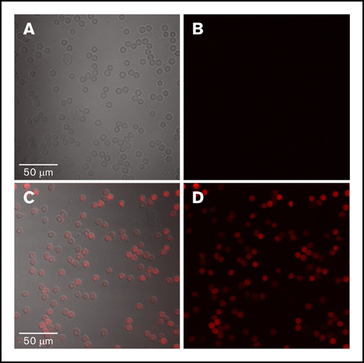Peripheral blood film. The blood film from a control subject (A and B) and a patient with erythropoietic protoporphyria (EPP) (C and D) all are wild-type at ABCB6. (A and C) The differential interference contrast (DIC) and fluorescence image are shown as an overlay. (B and D) Only fluorescence is shown. Fluorescent protoporphyrin is visualized by excitation at 405 nm with emission peak at 600 to 650 nm. Protoporphyrin is present in RBCs but not in lymphocytes. PPIX accumulates in EPP erythrocytes, suggesting that ABCB6 does not act as a PPIX exporter.