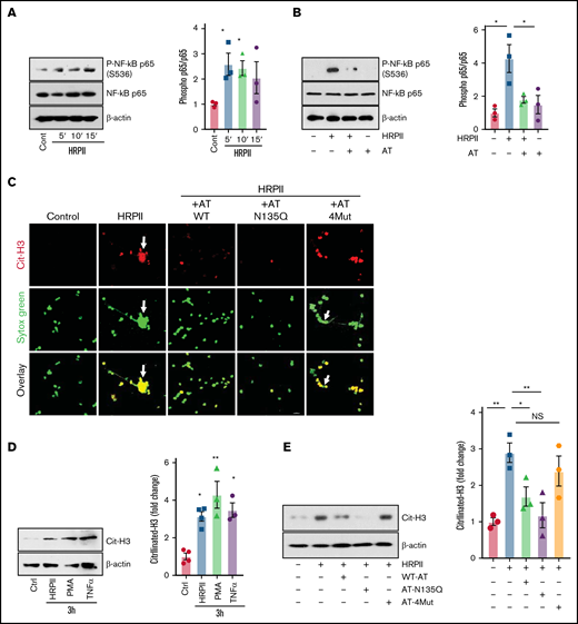 AT inhibits HRPII-mediated inflammatory responses in HL60 cells. (A) dHL60 cells were treated with HRPII (100 nM) for 5 to 15 minutes followed by the analysis of phosphorylation of NF-κB p65 by western blotting. Densitometric analysis is presented. (B) The same as (A) except that cells were treated simultaneously with HRPII and AT (2.5 µM) followed by the analysis of phosphorylation of NF-κB p65 by western blotting. Densitometric analysis is presented. (C) dHL60 cells on coverslips were treated simultaneously with HRPII (100 nM) and different AT derivatives (AT-WT, AT-N135Q and AT-4Mut (2.5 µM) for 4 hours and then fixed in 4% paraformaldehyde, permeabilized with 0.2% TritonX-100/PBS, and stained with anti-citrullinated H3 (rabbit polyclonal) antibody followed by Alexa Fluor 555-conjugated anti-rabbit antibody. DNA was stained with Sytox Green. (D) dHL60 cells were treated with HRPII (100 nM), TNF-α (10 ng/mL), or PMA (100 nM) for 4 hours followed by analysis of histone (H3) citrullination by western blotting. Densitometric analysis is presented. (E) The same as (D) except that cells were treated with HRPII and different AT derivative (AT-WT, AT-N135Q and AT-4Mut (2.5 µM) and histone (H3) citrullination were analyzed by western blotting. Densitometric analysis is presented.