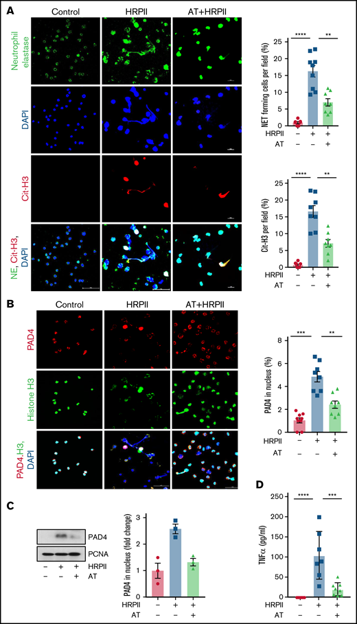 AT inhibits HRPII activation of neutrophils and NET formation. (A) Human blood neutrophils were isolated and treated with HRPII (100 nM) in absence or presence of AT for 4 hours. Cells were then fixed in 4% paraformaldehyde, permeabilized with 0.2% TritonX-100/PBS, and stained with anti-neutrophil elastase (goat polyclonal) antibody, anti-citrullinated H3 (rabbit polyclonal) followed by Alexa Fluor-488 conjugated anti-goat and Alexa Fluor 555-conjugated anti-rabbit antibody. DNA was stained with DAPI. Quantification of NET forming cells and citrullinated H3-positive cells per field represented as the percentage of the total cells. (B) The same as panels above except that human blood neutrophils were fixed and stained with anti-PAD4 (rabbit polyclonal) and antihistone (H3) (mouse monoclonal) antibody followed by Alexa Fluor 555-conjugated anti-rabbit antibody and Alexa Fluor 488-conjugated anti-mouse antibody. DAPI was used to stain the nucleus. Quantification of PAD4 nuclear translocation is represented next to the panel. (C) Human blood neutrophils were treated with HRPII in the absence and presence of AT. PAD4 levels in nuclear extract were analyzed through western blot. PCNA was used as loading control. Densitometric analysis is presented. (D) Human blood neutrophils were treated with HRPII in the absence and presence of AT. TNF-α levels in supernatant of neutrophils were measured using commercial ELISA.