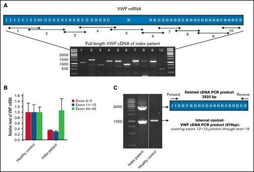 VWF mRNA transcription analysis. (A) The schematic scale of the VWF coding region (exons 2-52) with the position of designed primers for amplification of the full-length VWF cDNA and corresponding amplicons segments. Agarose gel electrophoresis image displays the 10 overlapping RT-PCR products of VWF using total RNA from the index patient (IP) as a template. (B) Comparative levels of IP-ECFCs VWF mRNA quantified by real-time PCR, using primer/probe combinations directing 3 different sites in VWF cDNA, across exons 4 and 5, 11 and 12, and 43 through 45. In the first set, the forward primer and the probe both were designed to target sequences in exon 4, and a reverse primer was designed across the exons 4-5 junction of VWF cDNA. In the second set, the forward and the reverse primers were directed at exons 11 and 12, respectively, and the fluorogenic probe targeted a sequence across the junction of the exons 11 and 12. In the third set, a fluorogenic probe as well as forward and reverse primers were targeting sequences in exon 44, exons 43 and 44, and 44 and 45 junctions, respectively. The measurements were performed based on the comparative CT (ΔΔ CT) method. Measurements of VWF mRNA levels were normalized to endogenous glyceraldehyde-3-phosphate dehydrogenase (GAPDH) or actin β (ACTB) mRNA. (C) Agarose gel electrophoresis of multiplex RT-PCR products amplified using primers designed across the junction of exons 2-3 (forward) and exons 51-52 (reverse) along with control internal primers (forward and reverse primers targeting sites in exon 12-13 junctions and exon 18, respectively). RT-PCR products of RNA obtained from the IP demonstrate a larger product (2820 bp) corresponding to the abnormal deleted VWF transcript derived from deleted VWF allele (del4-34) and a smaller fragment (979 bp) relevant to the normal transcript (lane 1). However, RT-PCR using RNA from healthy control as the template shows only the smaller normal fragment (lane 2). Molecular weight marker: GeneRuler 1kb ladder (Thermo Scientific, Germany).