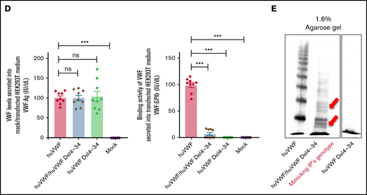 Intracellular storage and secretion of VWF in the ECFCs as well as expression of recombinant VWF in HEK293T cells. (A) Immunofluorescence images of ECFCs isolated from the IP and healthy individuals. In healthy ECFCs, VWF (green) is stored in rod-shaped organelles, resembling WPBs. However, VWF staining in the IP-ECFCs exhibited shorter WPBs than those observed in healthy ECFCs. The scale bar is 10 µm. Boxes signify close-up views of the processed 3D models of the WPBs granules surrounding with oriented bounds, generated by arivis Vision4D 3.2. The dot plot graphs demonstrate the quantitative morphological analysis of WPBs in healthy (black dot plot) and IP-ECFCs (pale red dot plot), including the average value of the longest (length), middle (depth), shortest sides (width), and sphericity factor (Ψ) of the selected 1000 WPBs. The sphericity factor, describing the roundness of the 3D granules, is represented as a value between 0 and 1, where 1 is an ideal sphere, and any particle that is not a sphere will have a sphericity < 1. IP-ECFCs demonstrated a decrease in length (1.69 ± 0.01 µm), depth (1.08 ± 0.01 µm), and width (0.91 ± 0.01 µm) of WPBs compared with wt (with an average length, depth, and width of 2.28 ± 0.01 µm, 1.37 ± 0.01 µm, and 1.2 ± 0.01 µm, respectively; P < .001). Furthermore, IP-ECFCs WPBs displayed a slightly increased sphericity value (0.61 ± 0.00 vs 0.59 ± 0.00 of wt WPBs; P < .001), favoring a less elongated shape. (B) The graph of the mean of VWF:Ag levels in the medium of ECFCs obtained from the IP (3 independent ECFCs isolation, each 3; N = 9) and 6 healthy donors (each 3 samples; N = 18). (C) The multimer profile of VWF in the supernatant of ECFCs analyzed by electrophoresis on 1.6% and 1.2% SDS-agarose gel. The multimer of VWF secreted from IP-ECFCs exhibited loss of large and intermediate multimers along with the shift in mobility of the small multimers (red arrows). (D) VWF:Ag levels (left) and VWF:GPIb (right) of secreted VWF into the medium of the transiently transfected HEK293T with huVWF (N = 9), huVWF/huVWF Del4-34 (coexpression at a ratio of 1:1; N = 9), and huVWF Del4-34 (N = 9) as well as untransfected cells (mock). (E) The multimer of recombinant VWF secreted into the medium of transfected huVWF, cotransfected huVWF/huVWF Del 4-34, and huVWF del 4-34 in HEK293T cell lines on 1.6% SDS-agarose gel. The multimer composition of secreted coexpressed huVWF/huVWF Del4-34 demonstrates the loss of large multimers along with a shift in mobility of the small multimers (red arrows) and homozygously expressed huVWF del 4-34 exhibited no multimer as expected. Error bars indicate the SEM. NS, not significant (P > .05); ***P < .001(unpaired Student t test).