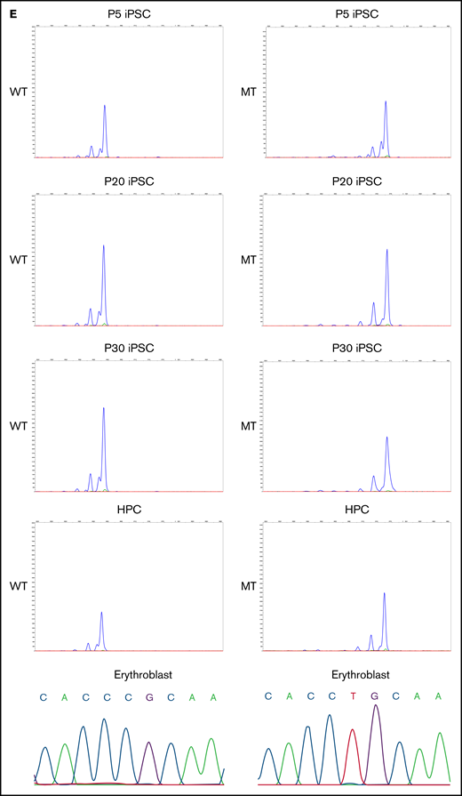 Generation of XLSA patient-derived iPSCs and confirmation of X-chromosome inactivation. (A) Schematic representation of the iPSC generation from PBMCs of female patients with XLSA who harbored a heterozygous ALAS2 mutation. The figure was created using BioRender.com. (B) Summary of HUMARA assays of PBMCs from patients with XLSA and the percentage of MT iPSC lines among established iPSCs. (C) Expression levels of OCT3/4, SOX2, and NANOG genes in PBMCs, 1 control iPSC line derived from a healthy donor, 3 WT iPSC lines, and 4 MT iPSC lines. Expression levels of PBMCs were set to 1. Each line was tested in 3 independent experiments. (D) HUMARA assays of WT and MT iPSCs (left). The undigested control is shown at the bottom left. Representative immunofluorescence staining images for Hoechst expression and H3K27me3 expression in iPSCs derived from patients with XLSA (right). Magnification of the objective lens: ×20. Bars represent 50 μm. (E) HUMARA assays of representative iPSC lines (WT1-iPSC3 and MT1-iPSC2) after 5, 20, and 30 passages and HPCs derived from the iPSC lines. Complementary DNA Sanger sequencing data of erythroblasts derived from the iPSC lines are shown on the far right.