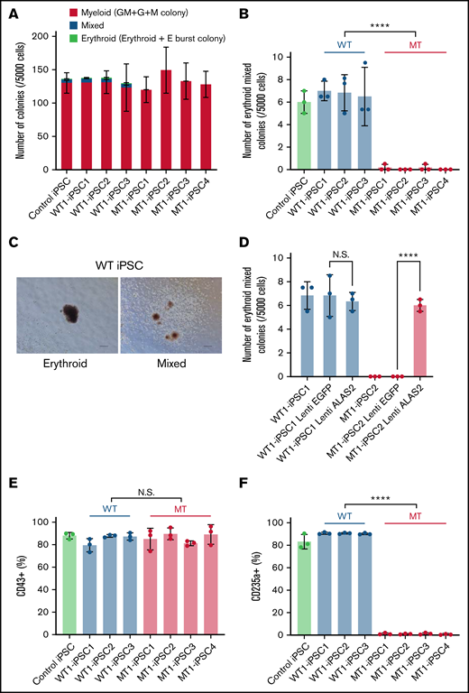 Impaired erythropoiesis in MT iPSCs. (A) Colony formation assay on day 14 of hematopoietic differentiation. Each line was tested in 3 independent experiments. (B) Erythroid and mixed colony counts in panel A. (C) Representative images of erythroid (left) and mixed (right) colonies derived from WT1-iPSC2. Magnification of the objective lens: ×4. Bars represent 200 μm. (D) Erythroid and mixed colony counts in MT HPCs transduced with WT ALAS2. Each line was tested in 3 independent experiments. (E) Percentages of CD43+ hematopoietic cells. Each line was tested in 3 independent experiments. (F) Percentages of CD235a+ erythroblasts. Each line was tested in 3 independent experiments. All data are presented as the mean ± standard error of the mean. P-values were calculated by using the unpaired, 2-tailed Student t test. ****P < .0001; N.S., not significant.