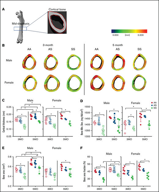 SCD mediates reduced cortical bone thickness in male and female mice. (A) Representative microCT image of an entire femoral bone, including a microCT scan of the mid-diaphysis outlined in red. (B) Representative three-dimensional heat maps of cortical thickness in the mid-diaphyseal region in AA, AS, and SS of 3-month-old (left) and 5-month-old (right) male and female mice. A pseudocolor scale of blue (0 mm) to red (0.2 mm) depicts cortical thickness. Cortical bone parameters generated by microCT scans for male and female mice include: cortical thickness (C); BMD (D); BA (E); and BA/TA (F). AA = black, AS = gray, SS = red. Data are expressed as mean ± standard deviation. Statistical significance, *P < .05, determined by two-way analysis of variance with Tukey’s post hoc test; n = 4 to 6 mice per group; scale bar, 100 μm. Bone Min. Den., BMD; HA, hydroxyapatite.