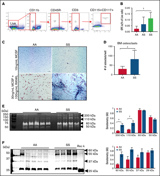 BM osteoclast progenitors are increased in SCD and produce increased amounts of active catK. (A) Flow cytometry identification of OPCs in the BM by gating for cells, live cells, CD11b–, CD45R/B220–, CD3–, and finally CD117+/CD115+ cells. (B) Quantification of OPC percentage of live cells in the BM of AA, AS, and SS mice (n = 5-8 mice per group). Data are expressed as mean ± standard deviation. Statistical significance, *P < .05, determined by one-way analysis of variance with Tukey’s post hoc test. (C) Representative images of BM cells from AA and SS mice treated with either 10 ng/mL M-CSF or 30 ng/mL M-CSF + 100 ng/mL RANKL for 21 days. Osteoclasts were determined as tartrate-resistant acid phosphatase–positive (pink) with at least 3 nuclei (blue). (D) Quantified number of osteoclasts per well (n = 4 mice and 8 wells per group). (E) Representative cathepsin zymograms of AA and SS osteoclasts. Active protein appears as white bands. Densitometry quantification of 200 kDa, 110 kDa, 60 kDa, and 50 kDa bands of active cathepsins in AA and SS osteoclasts (n = 4 mice per group). (F) Representative western blots of catK protein in AA and SS osteoclasts. Recombinant catK was used as a positive control. Densitometry quantification of 60 kDa, 55 kDa, 37 kDa, and 25 kDa bands of catK protein in AA and SS osteoclasts (n = 4-5 mice per group). AA = black, SS = red. Data are expressed as mean ± standard deviation. Statistical significance, *P < .05, determined by Welch’s t test. AU, arbitrary unit.