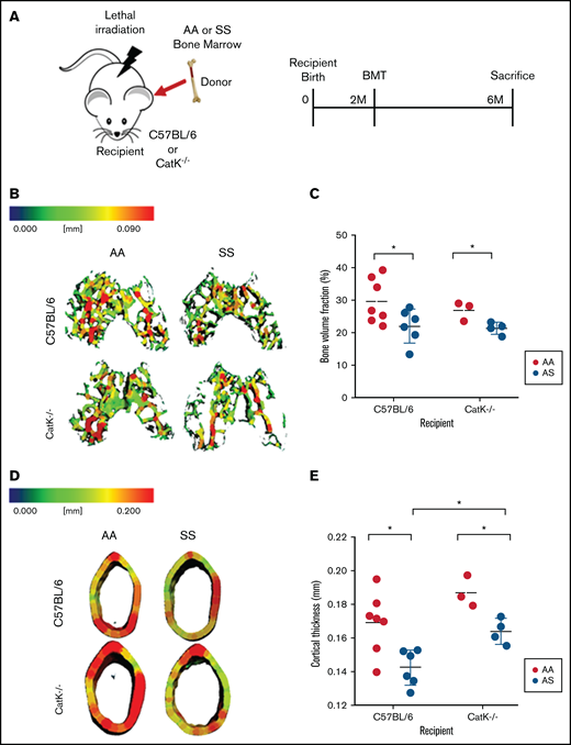 Absence of catK partially mitigates bone loss in SS BM chimeras. (A) Schematic and timeline of BMT studies. (B) Representative three-dimensional heat maps of trabecular morphology in the epiphysis region of the distal femur in C57BL/6 (top) and catK−/− (bottom) that were reconstituted with AA or SS BM. A pseudocolor scale of blue (0 mm) to red (0.09 mm) depicts trabecular thickness. (C) Trabecular BV/TV in the epiphyseal region generated by microCT imaging. AA BM = black; SS BM = red. (D) Representative three-dimensional heat maps of cortical thickness in the mid-diaphyseal region in C57BL/6 (top) and catK−/−(bottom) that were reconstituted with AA or SS BM. A pseudocolor scale of blue (0 mm) to red (0.2 mm) depicts cortical thickness. (E) Cortical thickness in the mid-diaphyseal region generated by microCT analysis. Data are expressed as mean ± standard deviation. Statistical significance, *P < .05, determined by multiple Student t tests with Holm-Šidák’s post hoc test; n = 3 to 7 mice per group; scale bar, 100 μm.
