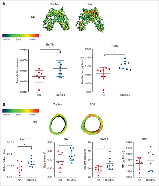 Two months of E-64 treatment of SS mice from 1 to 3 months of age shows increased trabecular and cortical bone thickness when analyzed at 3 months of age. (A) Representative three-dimensional heat maps of the epiphyseal region in SS 3-month-old mice administered saline or E-64 for 2 months, beginning at 1 month of age. A pseudocolor scale of blue (0 mm) to red (0.2 mm) depicts trabecular thickness. Trabecular bone parameters of trabecular thickness and BMD generated by microCT scans. (B) Representative three-dimensional heat maps of the mid-diaphyseal region in SS 3-month-old mice administered saline or E-64 for 2 months. A pseudocolor scale of blue (0 mm) to red (0.2 mm) depicts cortical thickness. Cortical bone parameters of cortical thickness, BA, BA/TA, and BMD generated by microCT scans. Data are expressed as mean ± standard deviation. Statistical significance, * P < .05, scale bar, E-64 or saline treated mice compared via t test. SS = black, SS with E-64 = red (n = 6-9 mice per group). Bone Min. Den., BMD; HA, hydroxyapatite.