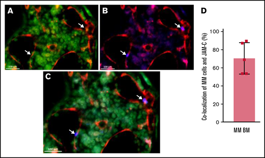 JAM-C signal co-localizes largely with BVs and CD138. Representative LSFM of intact long bones of an MM-bearing mouse. (A) Channel signals for BVs are shown in red (CD144-AF647) and CD138 signals are shown in green (CD138-AF488). (B) Channel signals for BVs are shown in red and JAM-C signals are shown in blue (AF555). (C) Overlay of panels A and B. Arrows indicate MM cells in proximity with BVs display remarkably high JAM-C signal and low CD138 expression. (D) Graphical analysis of co-localizing MM cells with JAM-C-signal within the BM of MM-harboring mice (n = 5). Error bars indicate standard deviation (SD).