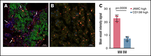 JAM-C signal is enhanced in the vicinity of BV signals but CD138 signal is diminished in these areas. Representative confocal microscopy image of intact long bones of (A) an MM-bearing mouse in comparison with (B) a nonaffected BM compartment (n = 3 mice); channel signals for BVs are shown in red (CD144-AF647), for CD138 are shown in green (CD138-AF488), and for JAM-C are shown in blue (JAM-C-AF555). Arrows indicate MM cells in proximity with BV signals that display higher JAM-C signal and lower CD138 expression. (C) Graphical analysis of mean fluorescence signal intensity of CD144 comparing CD138high and CD138low/neg JAM-C+ cells in MM-harboring BM regions. Unpaired, two-tailed Student t tests were used. Error bars indicate SD.