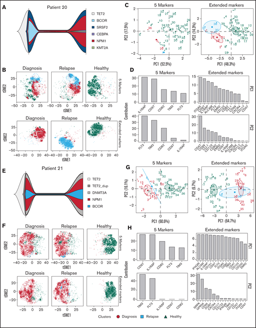 Further refinement of CombiFlow by including more PM markers. (A) Fish plots depicting mutational changes between diagnosis and relapse for Patient 20. (B) tSNE landscapes of Patient 20 created by the 5 markers (top) or aberrant markers selected from the 36-marker panel (bottom). (C) PCAs depicting 40 clusters colored by condition: diagnosis (red circle), relapse (blue square), and healthy (green triangle). PCAs were based on the 5 markers (left) or aberrant markers selected from the 36-marker panel (right). (D) Bar graphs depicting the ranking of the included markers for PC1 and PC2 based on the 5 markers (left) or aberrant markers selected from the extended 36-marker panel (right). (E) Fish plots depicting mutational changes between diagnosis and relapse for Patient 21. (F) tSNE landscapes of Patient 21 created by the 5 markers (top) or aberrant markers selected from the 36-marker panel (bottom). (G) PCAs depicting 40 clusters colored by condition: diagnosis (red circle), relapse (blue square), and healthy (green triangle). PCAs were based on the 5 markers (left) or aberrant markers selected from the 36-marker panel (right). (H) Bar graphs depicting the ranking of the included markers for PC1 and PC2 based on the 5 markers (left) or aberrant markers selected from the extended 36-marker panel (right).