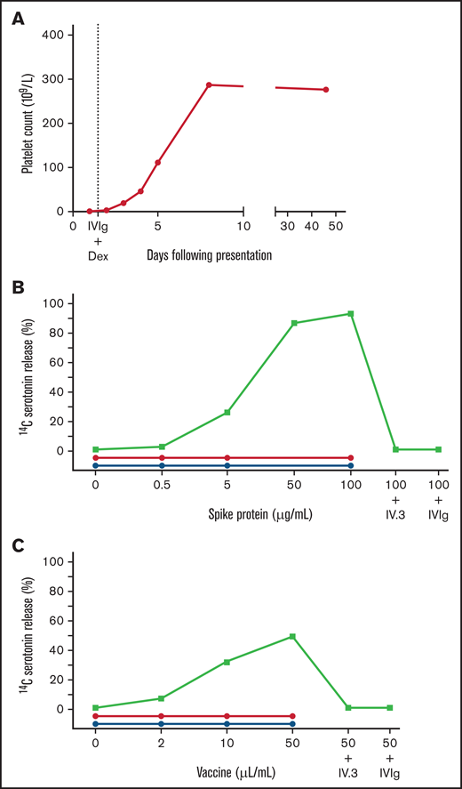 Patient platelet count and functional activation in VIT. Patient platelet count (panel A) and investigation of platelet activation using a modified SRA with exogenous addition of spike protein (panel B) or vaccine (panel C). The platelet count fully recovered by day 7 of treatment with dexamethasone (Dex) and IVIg. Serum from the patient (green squares) caused dose-dependent platelet activation and serotonin release with spike protein (93%; 100 µg/mL) and with vaccine (53%; 50 µL/mL). This effect was not observed with plasma from patients who recovered from severe (n = 5; red circles) or mild infection (n = 3; blue circles) with COVID-19. The activation was inhibited with FcγRIIa blockade using the monoclonal antibody IV.3 (5 µg/mL) or IVIg (400 µg/mL).