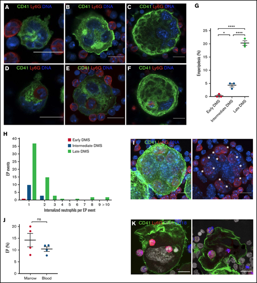 Visualization of EP in MKs of different maturational stages. Hematopoietic progenitor cells were cultured in TPO medium for 1, 2, or 4 days to obtain MKs of different maturation levels. MKs were then cocultured with bone marrow cells for 12 hours. MKs were stained with anti-CD41 AF488 (green), neutrophils were stained with anti-Ly6G AF594 (red), and DNA was stained with Hoechst 33342 (blue). MK maturity was graded based on the extent of the DMS (early, intermediate, and late DMS). Images were obtained using a Zeiss LSM 800 with Airyscan attached to a Zeiss Axio Observer Z1 Inverted Microscope with a Plan-Apochromat 63x objective. Scale bars, 10 µm. (A) Immature MK showing DMS beginning to develop between the nuclear lobes and forming connections with the MK surface (early DMS). (B) With increasing maturation, the DMS becomes more prominent and forms thicker connections with the MK surface (intermediate DMS). (C) Mature MK with extensive DMS occupying the majority of the MK cytoplasm (late DMS). (D-F) Early, intermediate, and late DMS MKs engulfing neutrophils during EP. (G) EP frequency across MK maturational stages. 100 MKs per maturational stage per experiment were counted in each of 3 independent experiments. (H) The number of engulfed neutrophils per EP event across MK maturational stages. Pooled data from 3 independent experiments (n = 300 MKs per maturational stage; EP events: early DMS MKs: 1, intermediate DMS MKs: 13, and late DMS MKs: 61). (I) Z-projection of mature MK (late DMS) containing 11 neutrophils (*s). (J) EP assay with neutrophils isolated from blood or bone marrow; 4 independent experiments. (K) EP assay with peritoneal cells harvested 2 hours after IP injection of 25 ng/mL IL1B. Green, CD41; red, Ly6G; blue, CD18; gray, DNA. Scale bars, 10 µm.
