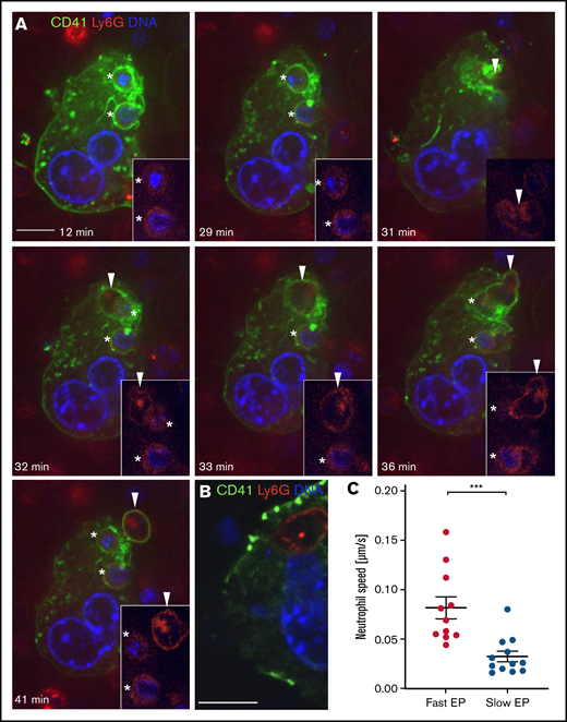 Distinct morphology of fast and slow EP within a single MK. Mature MKs were stained with anti-CD41 AF488 (green) and coincubated with fresh bone marrow cells stained with anti-Ly6G AF594 (red). DNA was stained with Hoechst 33342 (blue). (A-B) Images were obtained using a Perkin Elmer Ultraview Vox Spinning Disk Confocal attached to a Nikon Ti inverted microscope with a 60x (1.4NA) objective. Scale bars, 10 µm. (A) An MK showing fast and slow EP simultaneously to illustrate morphological differences of both forms. Two neutrophils undergoing slow EP (*) assume a sessile state. A third neutrophil (arrowhead) enters the MK after 31 minutes and extends dynamic membrane protrusions to propel itself through the MK cytoplasm, exiting within few minutes. (B) Representative image of a slow EP neutrophil residing near the MK nucleus. (C) The passage of neutrophils undergoing fast EP (<10 minutes) and slow EP (>60 minutes) through MKs was tracked using the ImageJ plugin TrackMate to determine the mean speed of migration.