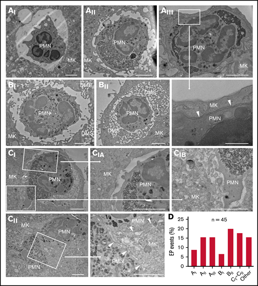 Characterization of the ultrastructural features of EP by electron microscopy. Mature MKs incubated with bone marrow cells for 12 hours were fixed and processed for transmission EM. Forty-five EP events were observed from 5 experiments. (Ai-Cii) Transmission EM images of EP. Scale bars, 2 µm or (for magnification of Aiii) 500 nm. (Ai) Large, round emperisome with a smooth vacuolar membrane surrounding a neutrophil (polymorphonuclear leukocyte, PMN). (Aii) The emperisome extends membrane protrusions toward the engulfed neutrophil. (Aiii) The emperisome tightly wraps around the engulfed neutrophil. Magnification shows close membrane approximation between neutrophil and emperisome membranes (arrowheads). (Bi) Internalized neutrophil partly covered by the emperisome and partly exposed to the DMS of the MK. (Bii) Neutrophil residing within the cavities of the DMS. (Ci) Internalized neutrophil partly covered by the emperisome (Cia) and partly exposed to organelles of the MK cytoplasm (Cib). (Cii) Two neutrophils fully reside inside the MK cytoplasm. Only the neutrophil membranes remain visible (arrowheads). (D) Frequency of the previously described EP stages (n = 45).