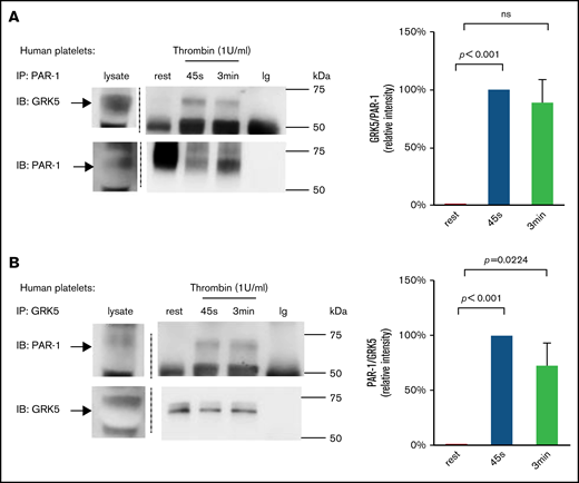 Activation of platelets with thrombin increases GRK5 and PAR-1 binding in human platelets. (A) Resting human platelets or thrombin (1 U/mL)-activated platelets were prepared and lysed. Proteins were precipitated with an anti–PAR-1 (ATAP-2) antibody or control immunoglobulin (Ig) and then probed with anti-GRK5 antibody and reprobed with an anti–PAR-1 antibody (n = 6). (B) Lysates from resting or activated platelets were precipitated with an anti-GRK5 antibody or Ig and probed with anti–PAR-1 before reprobing with anti-GRK5 (n = 3). IB, immunoblotting; IP, immunoprecipitation; ns, not significant.