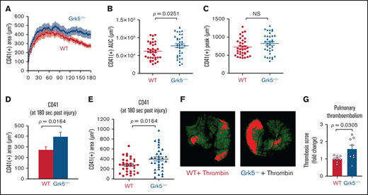 Increased platelet accumulation at the site of vascular injury in Grk5−/− mice. (A) Platelet accumulation was visualized by CD41 staining after laser injuries in cremaster muscle arterioles and recorded using confocal intravital fluorescence microscopy. (B) Area under CD41 vs time curve. (C) Peak of the CD41+ area at 180 seconds after injury. Bar graph (D) and dot plots (E) showing CD41 deposition at 180 seconds after injury. All data are mean ± SEM; 36 injuries in 3 WT mice and 36 injuries in 4 Grk5−/− mice. (F) Representative images of anti-GPIX–labeled thrombi in lungs harvested from WT and Grk5−/− mice. Images were acquired using the Odyssey LiCor imaging system. (G) Thrombosis score, representing the mean thrombus area and number of thrombi, for 8 WT mice vs 8 Grk5−/− mice. Group means were compared using the Student t test; P ≤ .05 was considered statistically significant. AUC, area under the curve; NS, not significant.