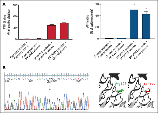A novel GP1BA variant in a PT-VWD patient. (A) Platelet/plasma mixing studies for VWF binding to platelets induced by ristocetin (1 mg/mL) assessed by flow cytometry. VWF binding was measured in the following mixtures: control platelets/control plasma, control platelets/proband (or PT-VWD) plasma, proband (or PT-VWD) platelets/proband (or PT/VWD) plasma and proband (or PT-VWD) platelets/control plasma. Binding of VWF to platelets is expressed as percent of positive platelets. Data are means ±SEM from 4 independent experiments, * = P < .05 vs control platelets + control plasma; Two-way ANOVA. (B) Sequencing of DNA from the proband, showing the heterozygous c.G380A variant in GP1BA (NM_000173.7) leading to p.Arg127Gln. On the right, close-up of the variant obtained by HOPE. GPIbα is colored gray, the side chains of both the WT and the mutant residue are shown and colored green and red, respectively.