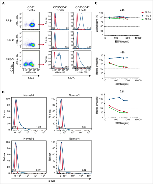 SGN-CD70A inhibits cell proliferation and induces apoptosis in CD70-expressing primary tumor cells from CTCL PDX mice. (A) CD70 expression levels by flow cytometry in primary malignant T cells harvested from spleens of CTCL PDX mice, PRS-1, PRS-2, and PRS-3. PRS-1 was generated from a patient with MF, and PRS-2 and -3 were generated from patients with Sézary syndrome, as described previously. (B) CD70 expression levels in T cells (CD3+CD4+) in the PBMC from 4 normal donors (Normal-1 through Normal-4). (C) Antiproliferative activity of SGN-CD70A in PRS-1, PRS-2, and PRS-3 primary tumor cells. The T-cell expansion was triggered by incubation with anti-CD2/CD3/CD28 beads in cell medium containing IL-2 (500 U/mL) and IL-7 (250 U/mL). Cell viability was determined at 24, 48, and 72 hours after treatment. (D) SGN-CD70A induces apoptosis in CD70-expressing primary tumor cells (PRS-1 and PRS-3) but not in tumor cells that do not express CD70 (PRS-2). The primary tumor cells harvested from spleens of PRS-1, PRS-2, and PRS-3 PDX mice were treated with various concentrations of SGN-CD70A, medium control (PBS), or IgG isotype control for 72 hours, and the apoptosis induction was analyzed by the annexin V/PI assay.