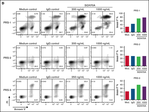 SGN-CD70A inhibits cell proliferation and induces apoptosis in CD70-expressing primary tumor cells from CTCL PDX mice. (A) CD70 expression levels by flow cytometry in primary malignant T cells harvested from spleens of CTCL PDX mice, PRS-1, PRS-2, and PRS-3. PRS-1 was generated from a patient with MF, and PRS-2 and -3 were generated from patients with Sézary syndrome, as described previously. (B) CD70 expression levels in T cells (CD3+CD4+) in the PBMC from 4 normal donors (Normal-1 through Normal-4). (C) Antiproliferative activity of SGN-CD70A in PRS-1, PRS-2, and PRS-3 primary tumor cells. The T-cell expansion was triggered by incubation with anti-CD2/CD3/CD28 beads in cell medium containing IL-2 (500 U/mL) and IL-7 (250 U/mL). Cell viability was determined at 24, 48, and 72 hours after treatment. (D) SGN-CD70A induces apoptosis in CD70-expressing primary tumor cells (PRS-1 and PRS-3) but not in tumor cells that do not express CD70 (PRS-2). The primary tumor cells harvested from spleens of PRS-1, PRS-2, and PRS-3 PDX mice were treated with various concentrations of SGN-CD70A, medium control (PBS), or IgG isotype control for 72 hours, and the apoptosis induction was analyzed by the annexin V/PI assay.
